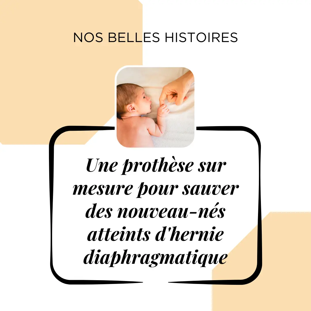 An innovative prosthesis for improved management of congenital diaphragmatic hernia